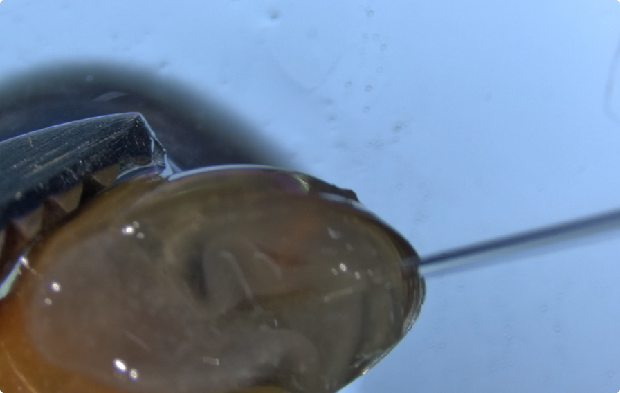 宿主体外で操作した虫体を宿主に戻す：ヒメモノアラガイへの虫体の移入（4）