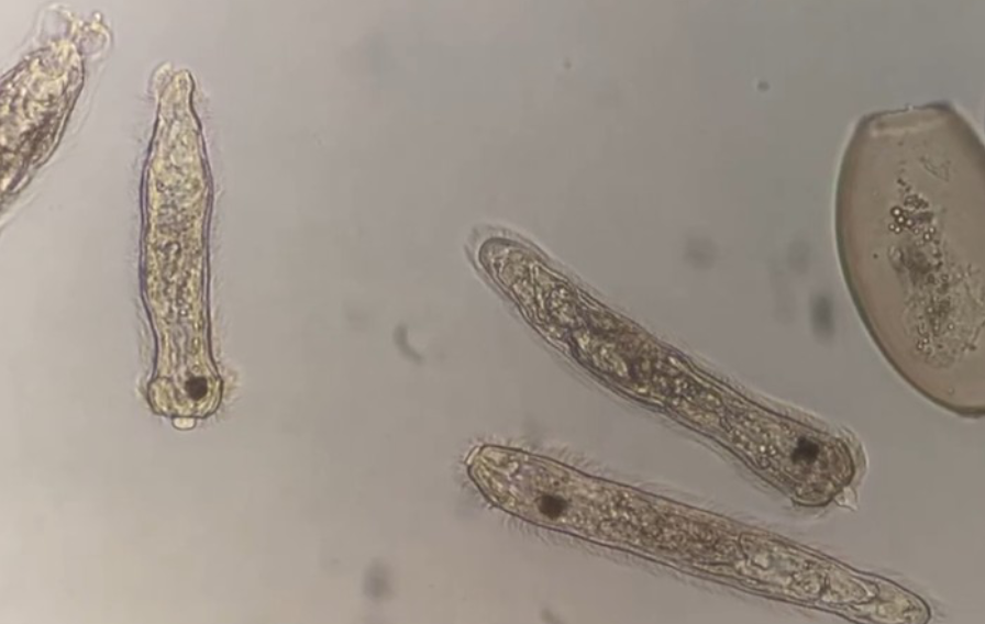 肝蛭虫卵より孵化したミラシジウム